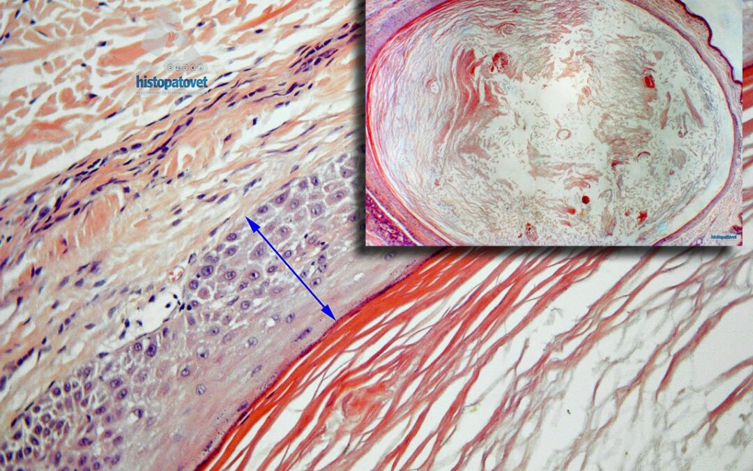 Enero-Febrero-2011.Quistes foliculares