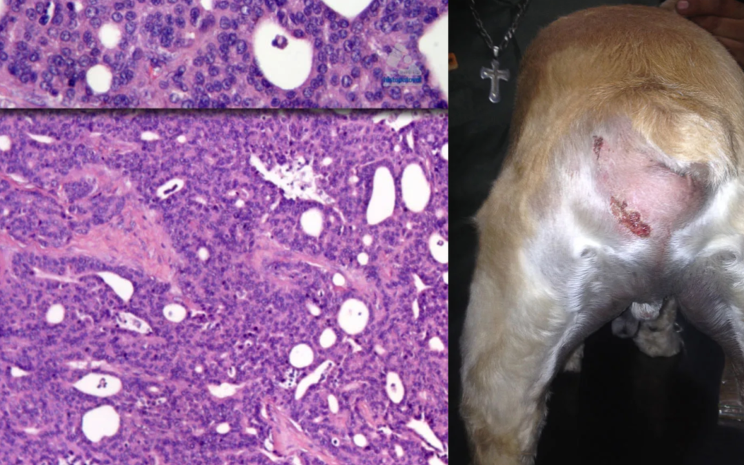 Junio-Julio 2014-Carcinoide