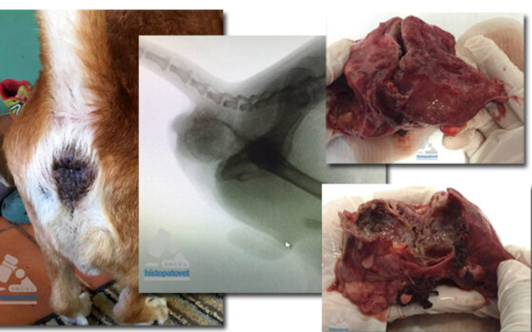 Mayo-Agosto,2016. Adenocarcinoma Complejo con metaplasia ósea