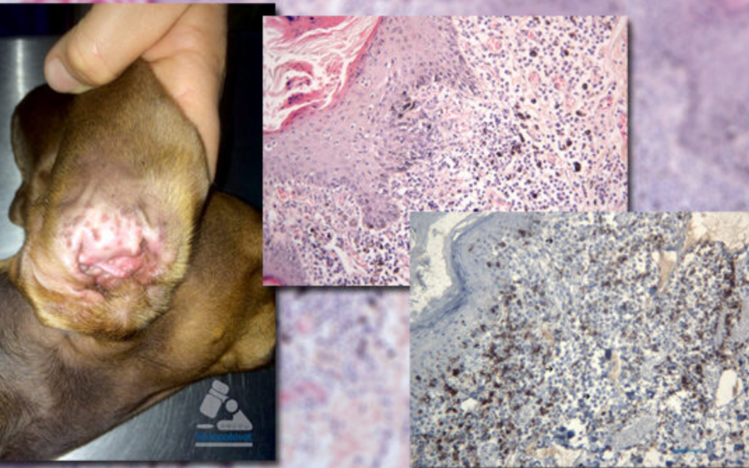 Septiembre-Diciembre, 2016. Dermatosis liquenoide