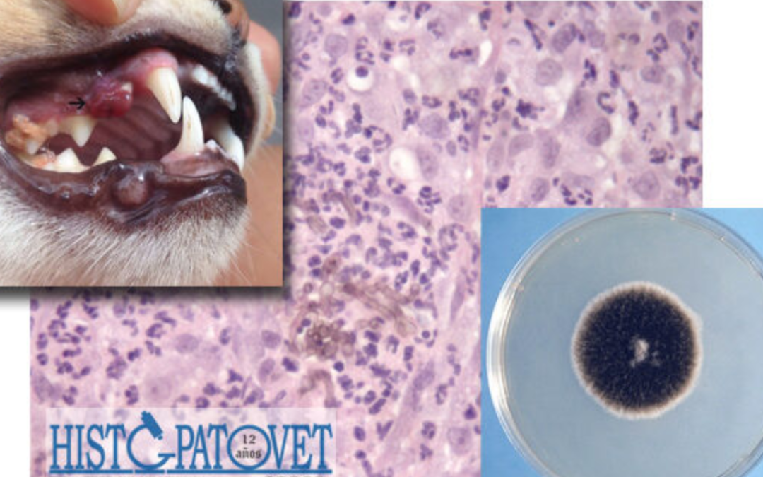 Enero-Abril-2017-Gingivitis Micotica