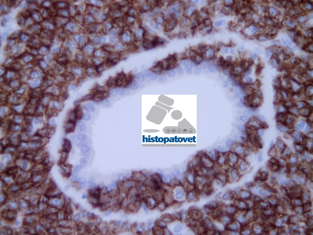 Copia de AB-288-22-60-Sudoripara-Invasion copia